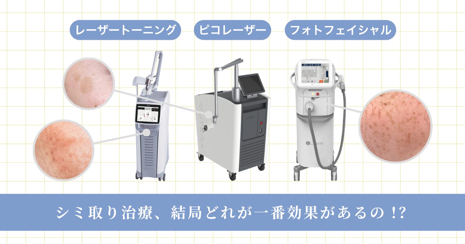 シミ取り治療、結局どれが一番効果があるの！？ | 新宿・大阪心斎橋